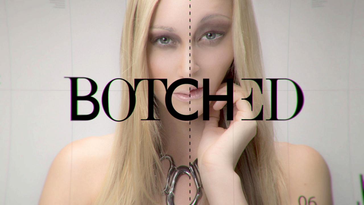 Изуродованные тела. Сезон 2. Серия 3. (Botched. S02E03)